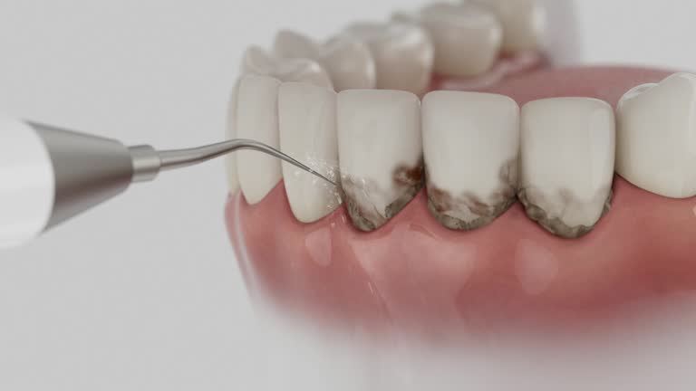Reliable Emergency Dentist contractor in Rice, MN by Smile Center Dentistry